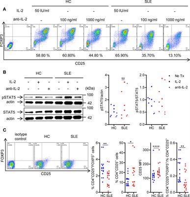 Double-Edged Sword: Interleukin-2 Promotes T Regulatory Cell Differentiation but Also Expands Interleukin-13- and Interferon-γ-Producing CD8+ T Cells via STAT6-GATA-3 Axis in Systemic Lupus Erythematosus